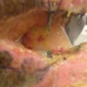 Helende sår på hestebeinet